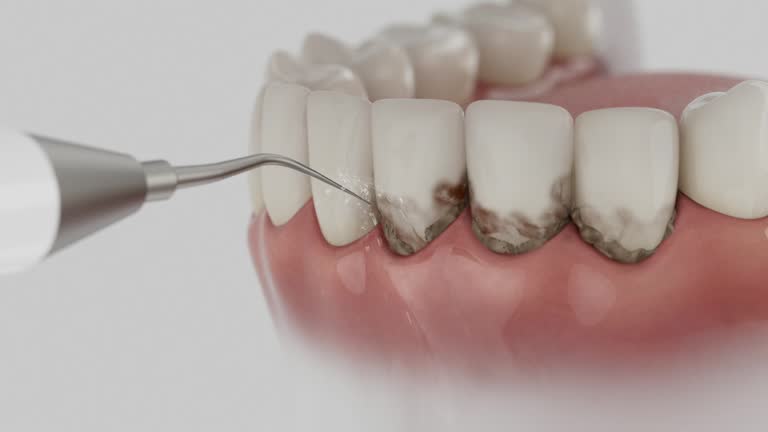 Reliable Dental Implants contractor in Jackson, MN by Smile Center Dentistry